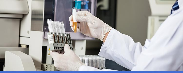 Lab Testing Near Me in Los Altos, MA