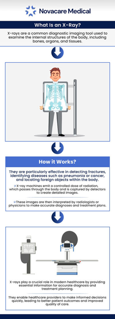 An X-ray is a painless treatment that is used to diagnose numerous medical disorders. It is frequently employed to create an image of the body's interior. Mostly this procedure is used to examine joints and bones but sometimes it can also be used to analyze soft tissues such as internal organs. Our skilled team of medical professionals at ABC Medical Group provides X-ray services to identify many conditions, such as tumors, some traumas, calcification, foreign objects, and shattered bone fractures. To learn more about the benefits of X-rays services, contact us today or book an appointment online. We are located over at 123 ABC Ave Suite A, Los Altos, CA 123456.