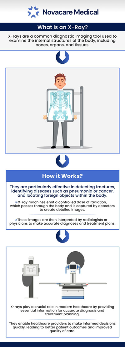 A chest X-ray is a non-invasive imaging test used by healthcare providers to examine the heart, lungs, blood vessels, airways, and bones in the chest, helping in the diagnosis of conditions like pneumonia and broken bones. At ABC Medical Group, our board-certified Dr. Akash Patel, MD, offers chest X-rays. For more information, contact us or schedule an appointment online. We are conveniently located at 123 ABC Ave Suite A, Los Altos, CA 123456. A chest X-ray is a non-invasive imaging test used by healthcare providers to examine the heart, lungs, blood vessels, airways, and bones in the chest, helping in the diagnosis of conditions like pneumonia and broken bones. At ABC Medical Group, our board-certified Dr. Akash Patel, MD, offers chest X-rays. For more information, contact us or schedule an appointment online. We are conveniently located at 123 ABC Ave Suite A, Los Altos, CA 123456.