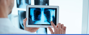 Chest X-Ray Clinic Near Me in Los Altos, MA Chest X-Ray Clinic Near Me in Los Altos, MA