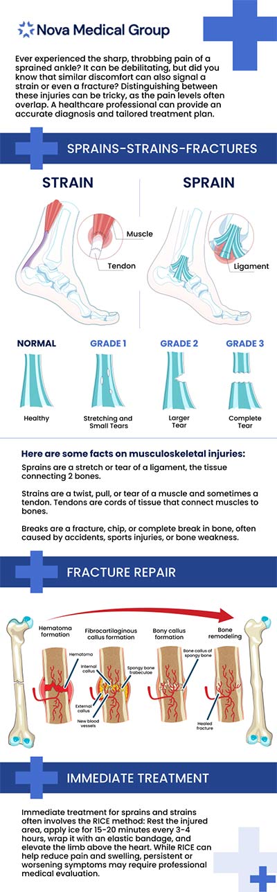 A bone fracture happens when something strikes your bone with enough force to not only cause harm but also break it in at least one spot. Symptoms include sharp pain, swelling, and difficulty utilizing or moving the damaged area. At ABC Medical Group in Los Altos, MA Dr. Akash Patel, MD, a board-certified physician, provide comprehensive treatment for broken bones and various other injuries. If you suspect you've broken a bone, avoid delaying getting professional care because it could lead to serious complications that disrupt your everyday life. For more information, contact us today or book an appointment online. We are located at 123 ABC Ave Suite A, Los Altos, CA 123456.